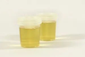 Polisi Ungkap Hasil Tes Urine, Usai Periksa Remaja Pelaku Pembunuhan Ayah dan Neneknya di Jaksel